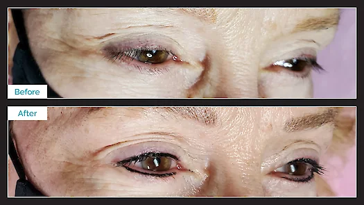 Permanent Eyeliner - Top & Bottom