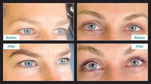 Lash Lift & Tint - Before & After